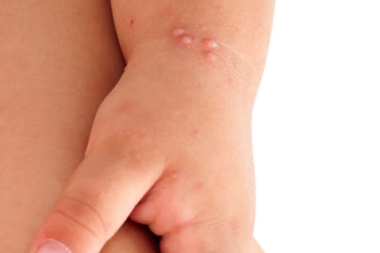 dermatologia pediatrica dra vanessa labanca